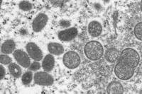 electron microscope image of Monkeypox.