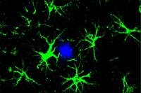 Green and blue splotches.